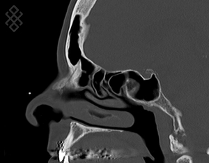 Scanner des Sinus