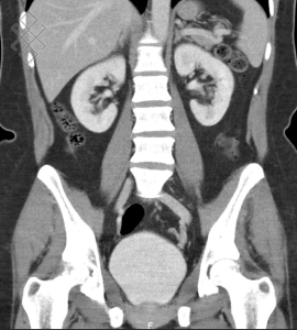 Uroscanner